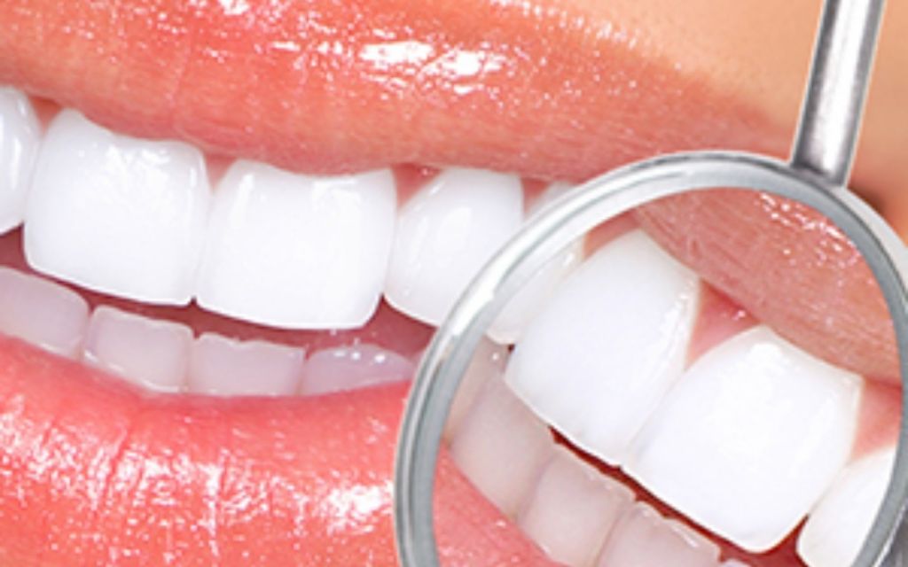 Close up of a bright white smile with a dentist's inspection tool